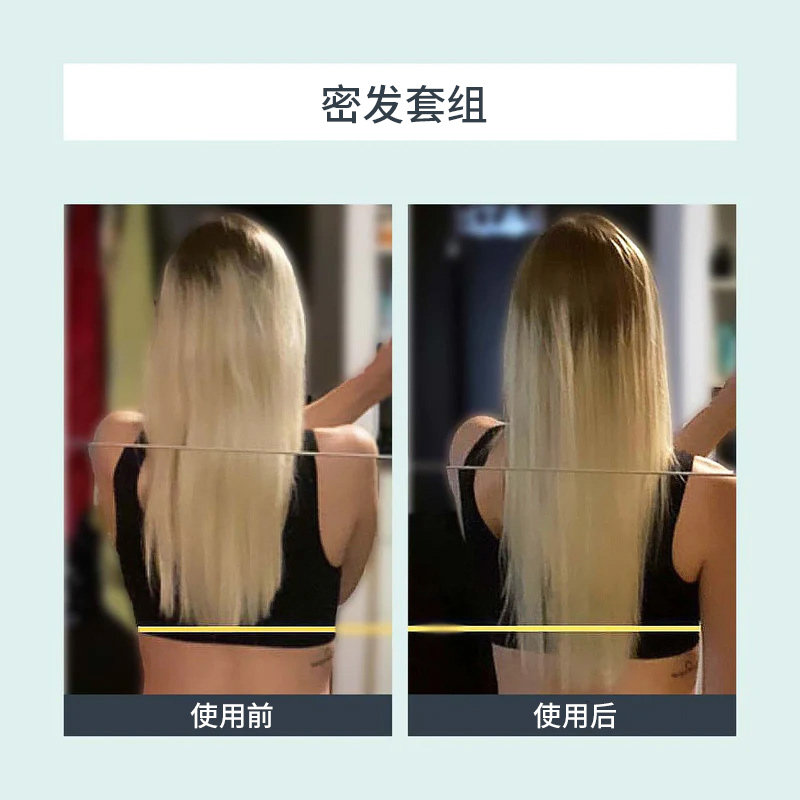 [密发套组3月装】DLAB法国密发精纯角蛋白84+密发丸168粒丰发精选,淘宝优惠券,粉丝福利购,淘宝优惠卷