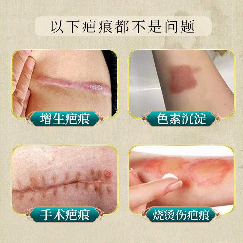 丹参疤痕保健膏香港大药房旗舰店皮肤损伤蚊叮虫咬术后疤痕通用11