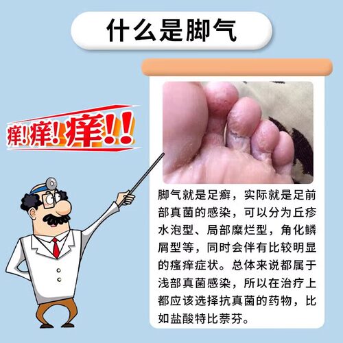 治脚气专用药水泡脱皮止痒烂脚丫痒脚趾缝糜烂型治疗真菌感染 - 图0