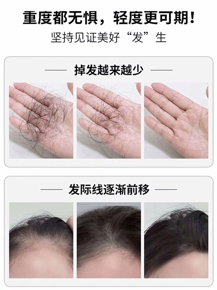  三晖堂大药房白发脱发