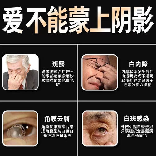 消朦片治疗白内障的眼药中老年白内障看不清视线模糊眼球混浊重影 - 图2