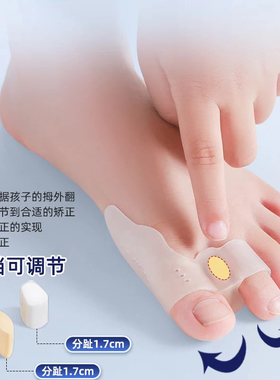 德国儿童大拇指外翻矫正器可穿鞋