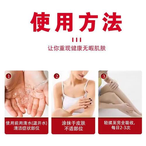 牛皮藓真菌王抑菌乳膏草本手足藓股藓外阴瘙痒手足脱皮膏天猫正品 - 图1