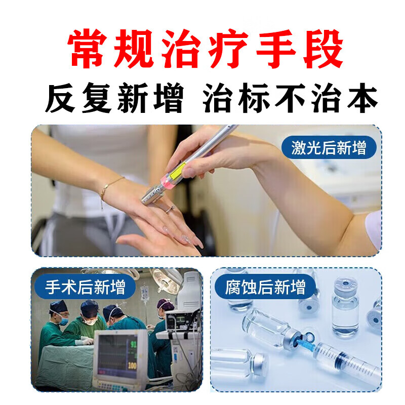 女性外阴假性尖锐湿疣去私处抗疣软膏除菜花状疣鬼臼毒素软膏XP - 图1