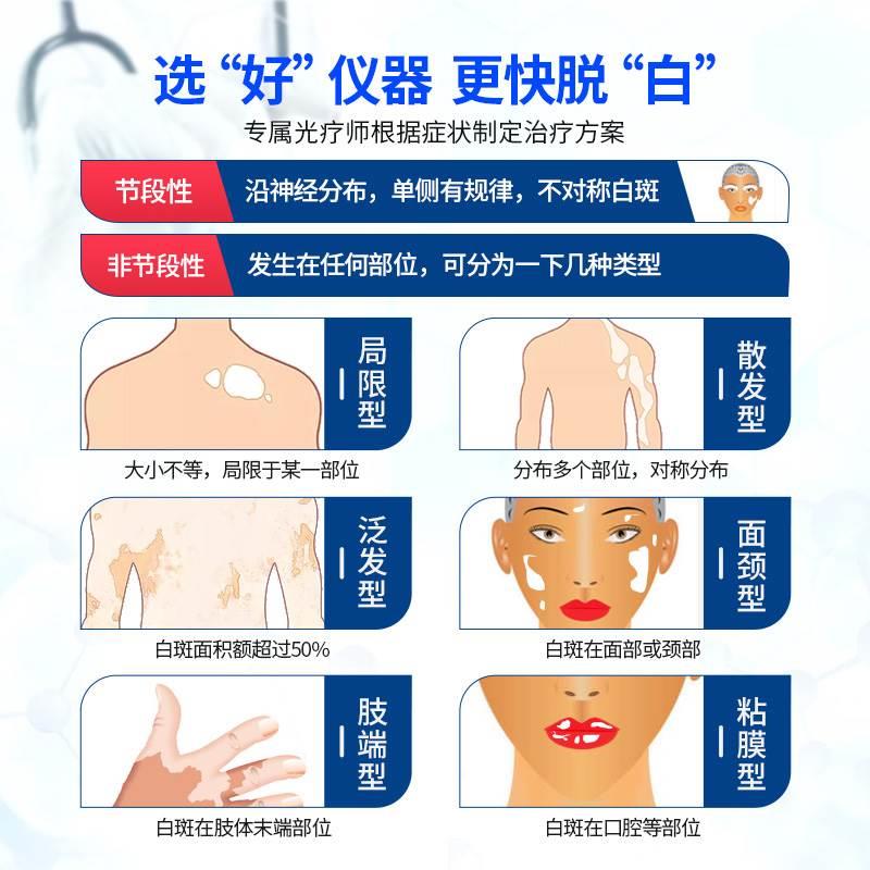 308nm准分子光疗仪 白癜风银屑病家用紫外线理疗灯医用激光治疗仪 - 图2