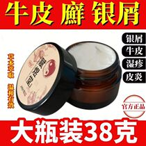 (Official) (Endowed With the Hall) Stubborn Psoriasis Silver Scraps External Use Special Cream Eczema Dermatitis Hands Foot