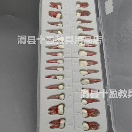 牙医考试练习口腔带髓腔根管牙粒树脂牙开髓牙粒全口28颗备牙模型 - 图2