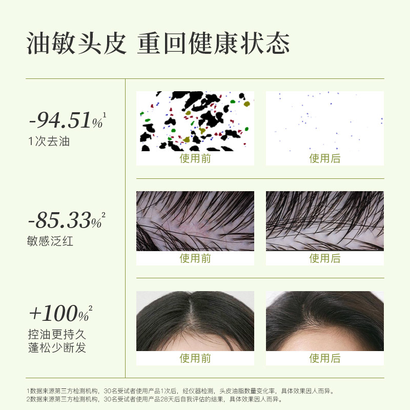 【明星推荐】自漾头皮净化油预洗油头皮清洁控油蓬松舒缓先试后买,淘宝优惠券,粉丝福利购,淘宝优惠卷