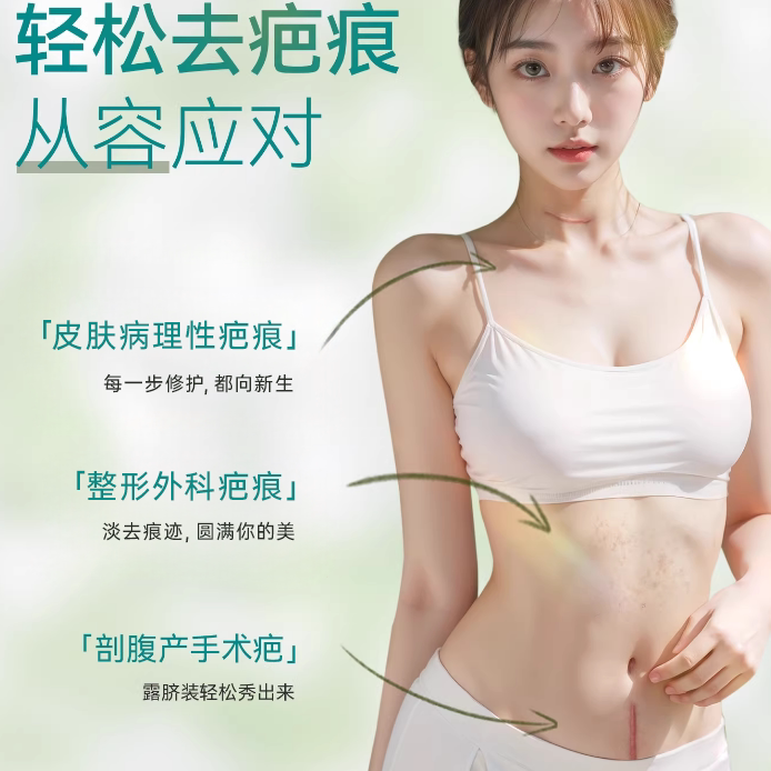 三豸堂疤痕贴医用剖腹产术后烧伤烫伤伤口防水疤硅酮凝胶贴