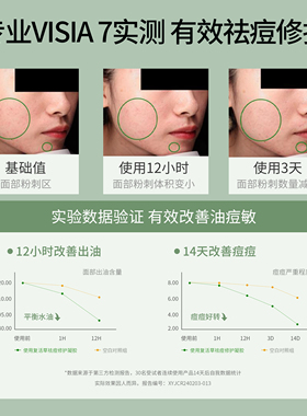 UIR复活草袪痘修护凝胶精华膏痘印敏感肌闭口舒缓控油学生青少年