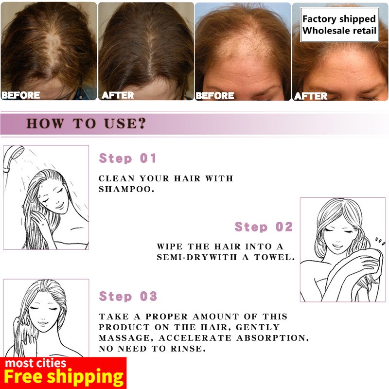 网红Moroccan Prevent Hair Loss Product Growth Essential Oil - 图2