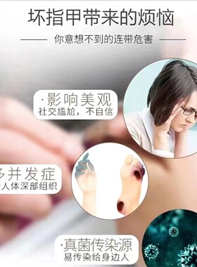 好货指甲修复液受损甲床增厚护理营养液分离空甲开裂薄软凹凸不平