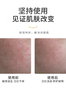 【厂家直销】正品美容院线乳液