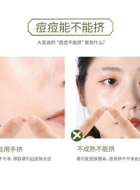 【美容院专用】粉刺黑头轻松清洁