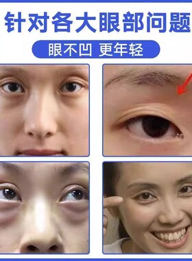 新品眼窝凹陷修复去除泪沟神x器改善三眼皮变双眼皮松弛提拉紧致