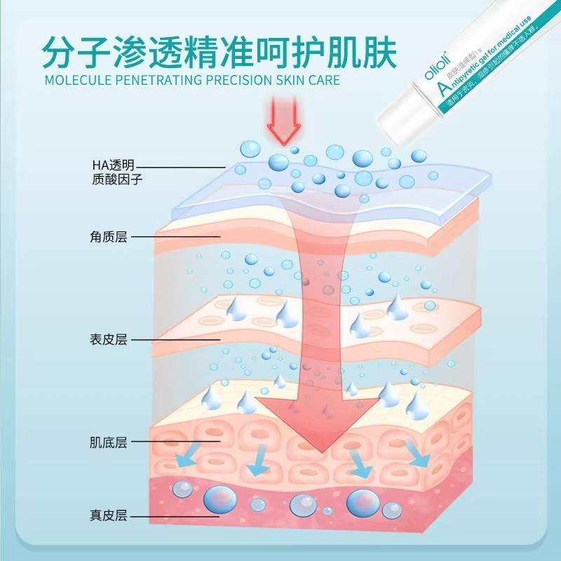 olioli皮炎湿疹膏皮肤湿痒医用凝胶瘙痒泡疹外用慢性皮炎止痒抑菌-图1