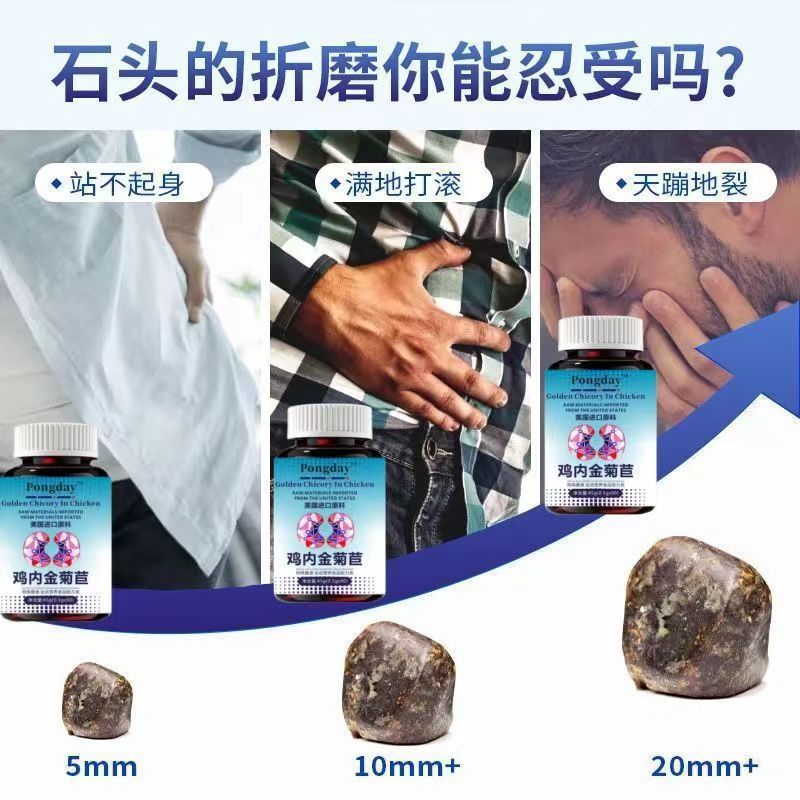 肾结石排石专用鸡内金药中草药金钱草茶特效治疗的颗粒溶石化石胆