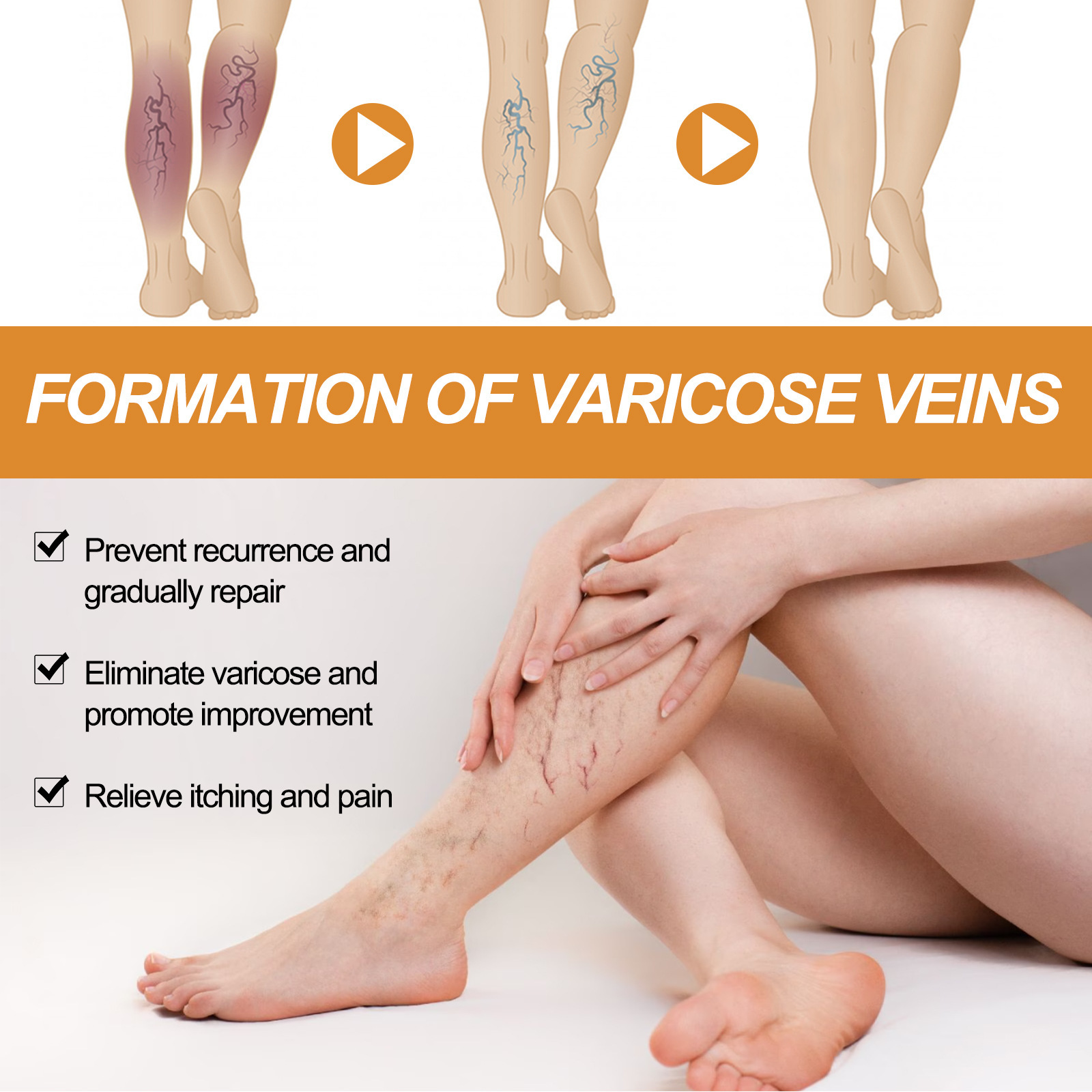 Intravenous care cream relieves leg discomfort and moisturiz - 图1