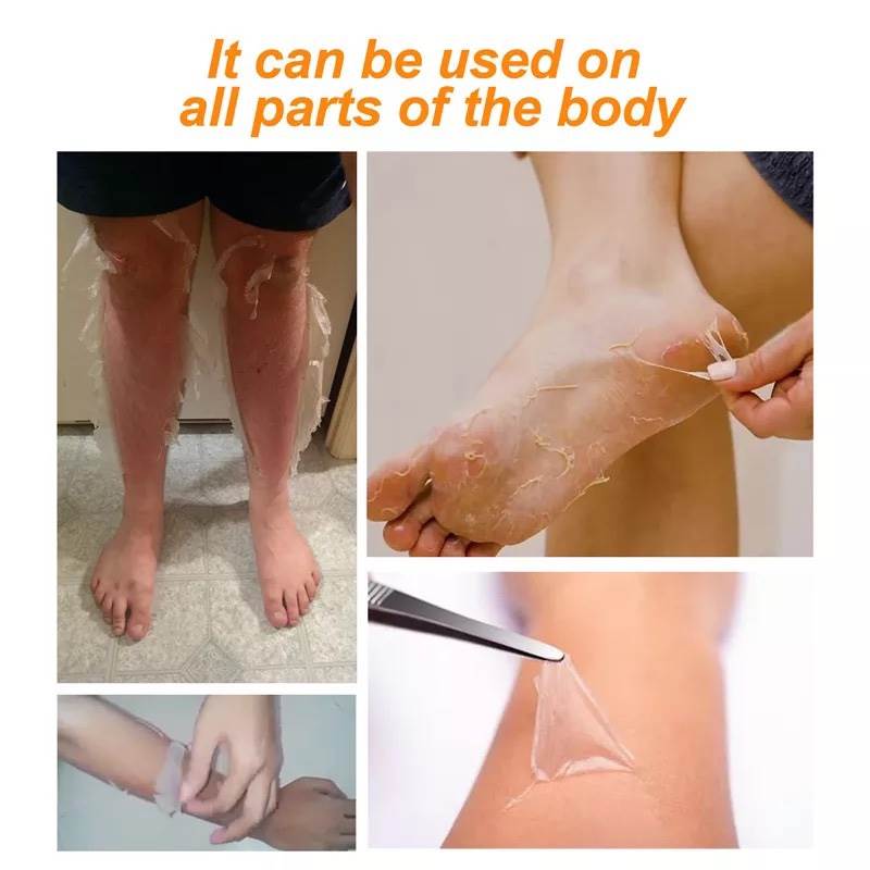 速发Whitening Peel Peeling Gel Peeling Mask Fnger Knee Brigh - 图2