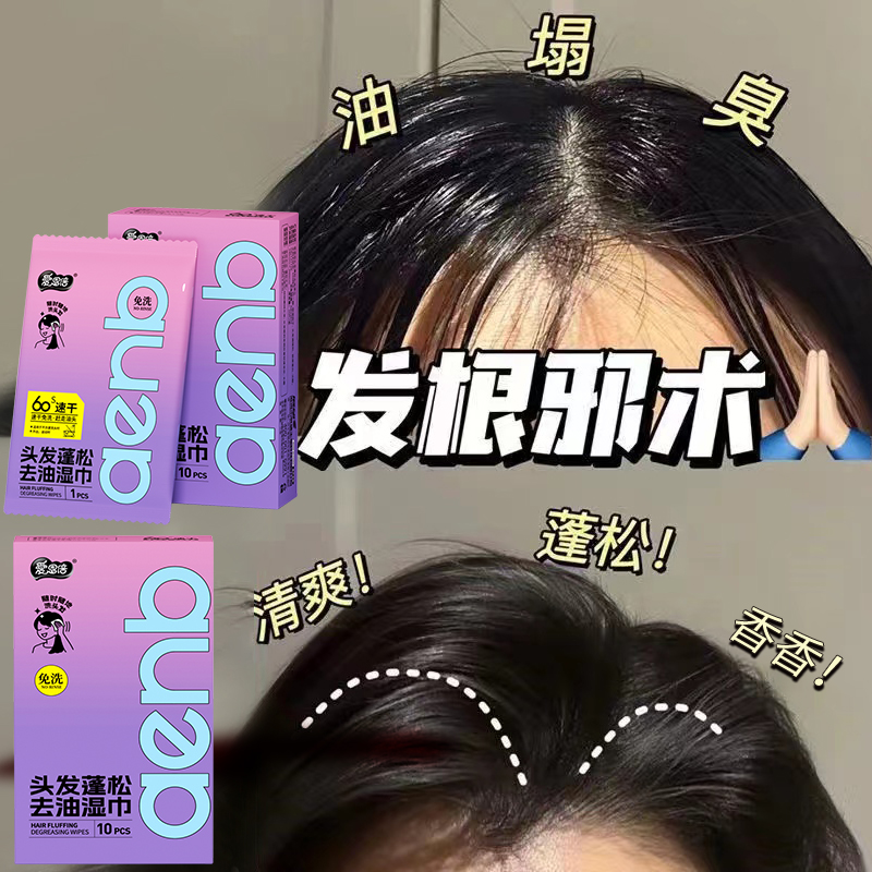 爱恩倍去头油刘海去油湿巾头发蓬松免洗吸油懒人学生宿舍军训小包