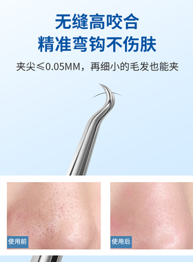 5号升级版超细细胞夹去黑头镊子美容院专用高精密刮闭口粉刺痘针