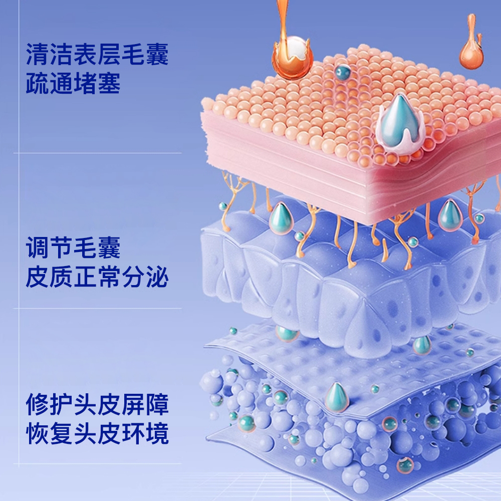 臻羞毛囊净喷雾清洁头皮发丝护发养发液去头屑精华