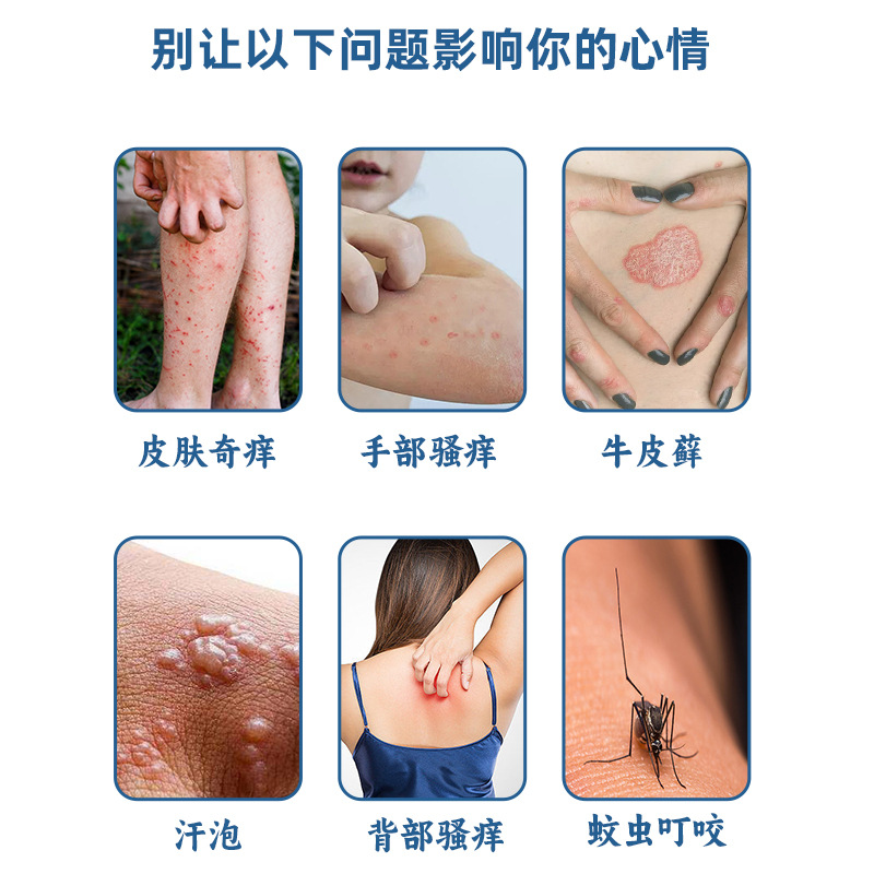 苗三叔五毒癣痒王草本抑菌乳膏皮肤外用老人小孩止痒乳膏