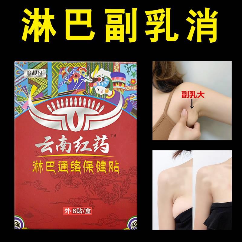 网红淋巴散结膏正品淋巴结消贴去结节收副乳消除神器腋下消除贴疏-图0