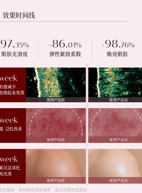 Eveline尿素+维A酸+维生素E