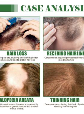Batana hair essential oil滋润柔顺秀发发根护发巴塔纳头发精油