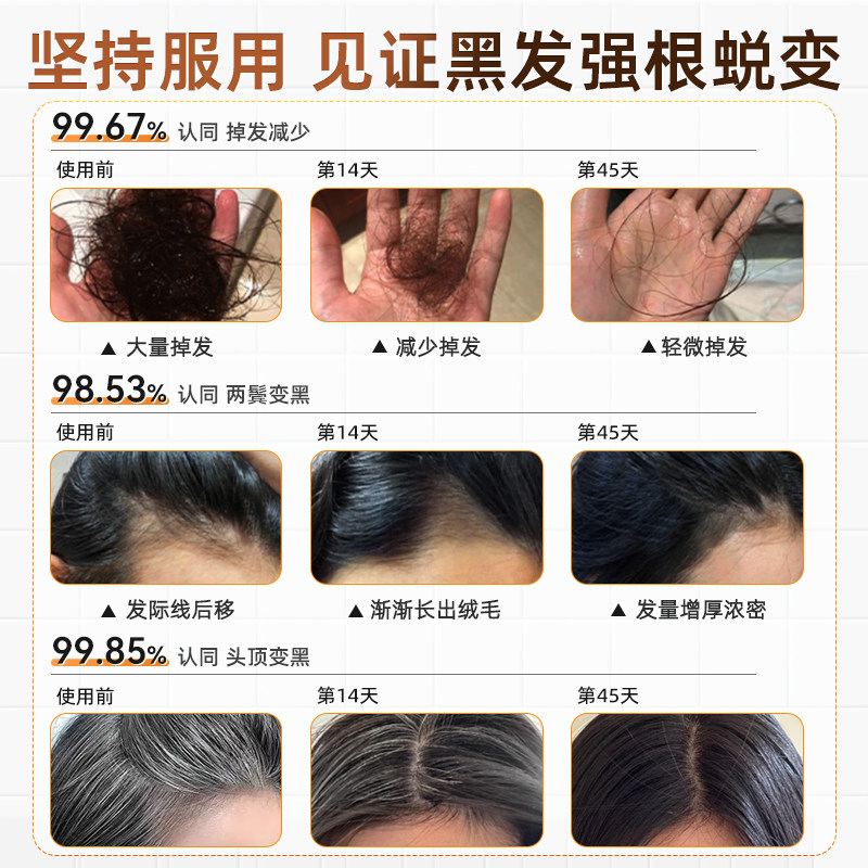 AIAF艾弗维生素B族乌发素白发脱发生物素黑发养发男女,淘宝优惠券,粉丝福利购,淘宝优惠卷