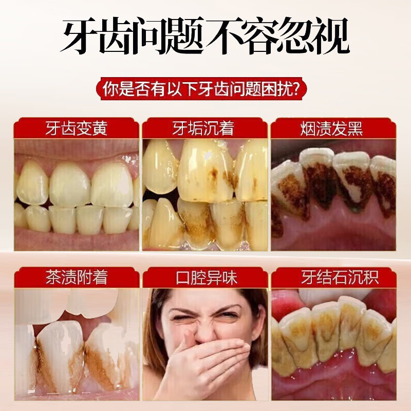 牙冠军美白去渍牙膏去黄去口臭抗牙结石去牙菌斑修护牙齿2盒装