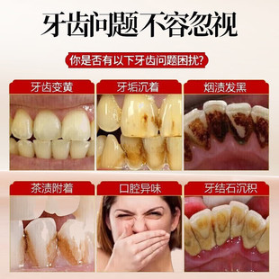 两支专效抗牙结石牙膏亮白去渍修护牙釉质