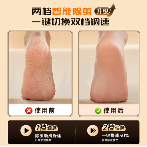 德国DORD电动修脚器强力大功率去死皮老茧磨脚石搓脚家用磨脚2026 - 图2