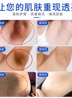 【泰国同款腋下美白】