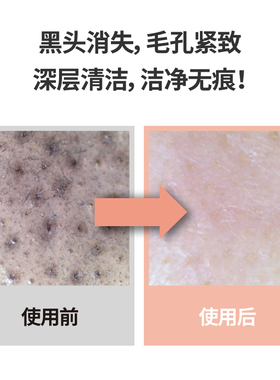 临期善自然弱酸性敏感肌卸妆膏