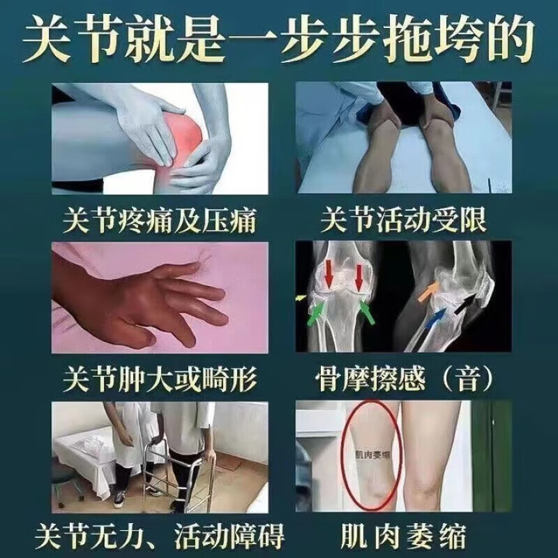 骨友灵贴膏治疗筋骨疼痛腰肌劳损药膏扭伤拉伤摔伤消肿止痛贴膏
