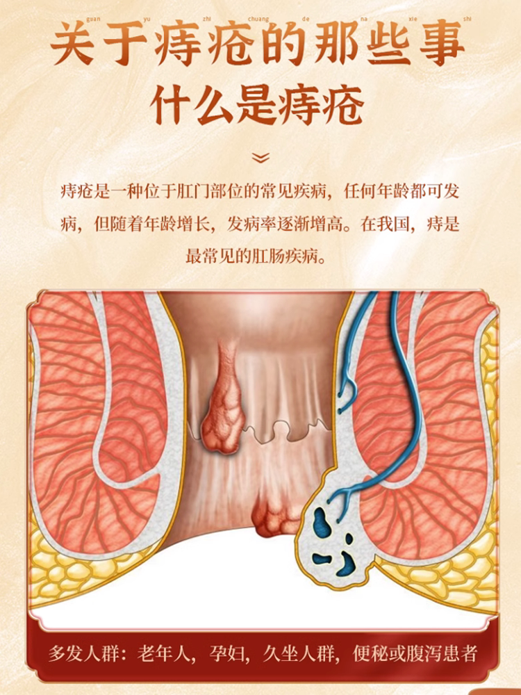 槐角丸治大便出血药便血药痔疮肿痛肠风便血清肠疏风凉血止血