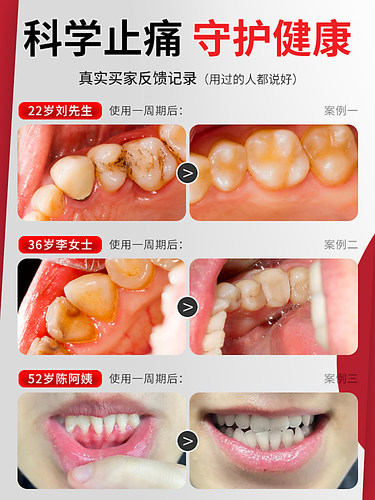 牙疼止疼药速用效专药消炎牙龈肿痛治牙痛止痛特药效止痛牙痛药水 - 图1