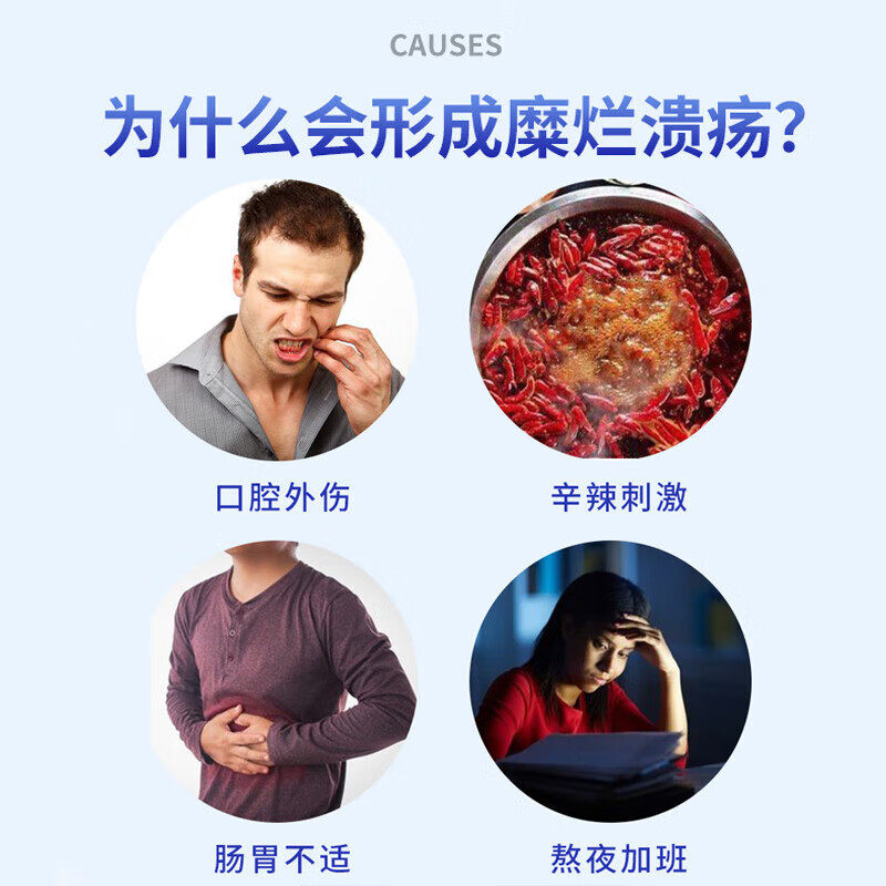 口腔溃疡专用药贴烂嘴巴烂舌头口舌生疮起泡灼痛反复口疮溃疡肿痛