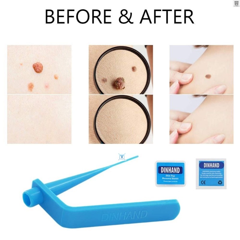 新品Skin tag remover wart Remove Acne Pimple Blemish Treatme-图2