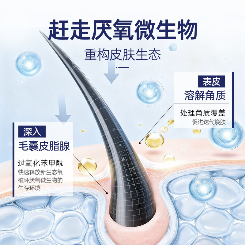 PANOXYL10%过氧化苯甲酰bpo洗剂液身体祛痘香肥皂固体沐浴露 临期,淘宝优惠券,粉丝福利购,淘宝优惠卷