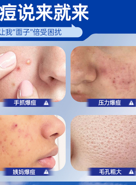 PANOXYL痘痘贴隐形祛痘贴女男生
