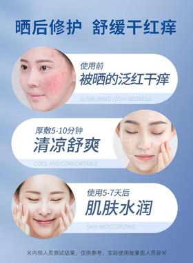 冷凝胶军训皮肤修护晒后伤专用学生党神器非医用正品