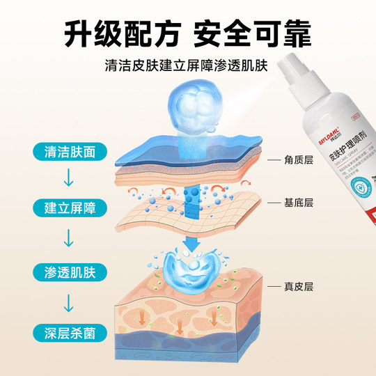 Baidar cat moss external use of cat ringworm special dog moss dog skin disease fungus non-medicine pet spray dog ​​ringworm spray