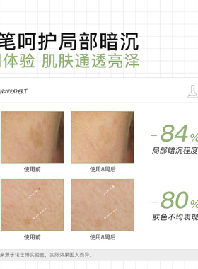 诺士博高效点褪焕亮精华笔孕哺