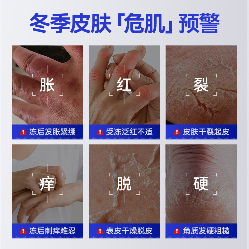 LAPOR马油干裂脱皮冻疮膏止痒防脱皮干裂滋润保湿手足冻疮膏正品A