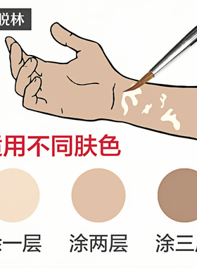 脸部身体手防水白斑外用遮盖液