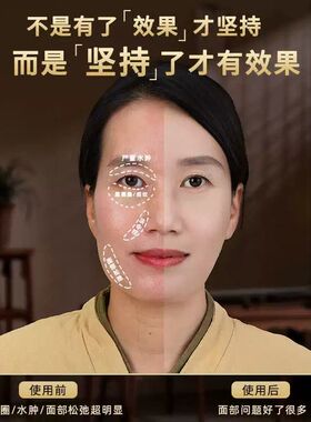 丰林黄铜眼睛眼部拨筋棒面部经络穴位工具脚底刮痧棒按摩笔点穴棒