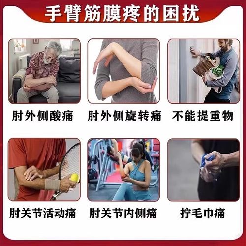 正品手臂筋膜炎筋络透骨液胳膊疼痛手肘疼痛肌肉酸痛劳损拉伤 - 图1